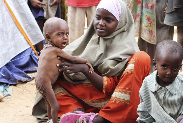 The UN and Genocide by Starvation in Somalia